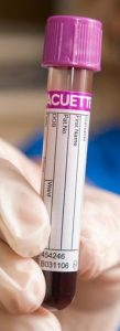 fertility testing miscarriage testing