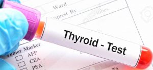 thyroid testing Lancaster PA